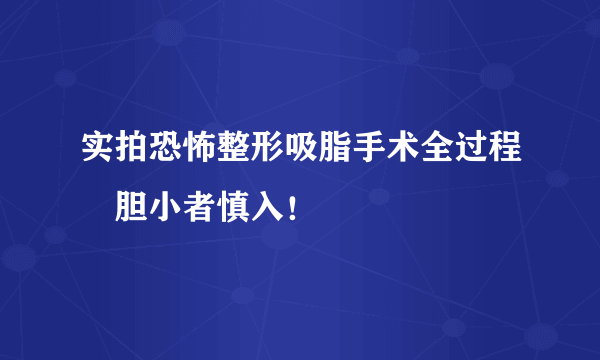 实拍恐怖整形吸脂手术全过程　胆小者慎入！